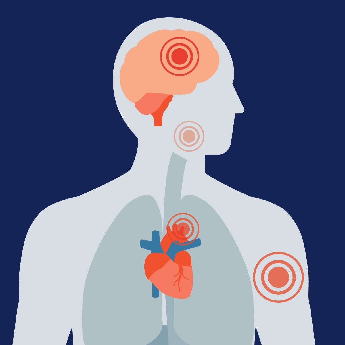 Image Result For Heart Symptoms Causes Mayo Clinic